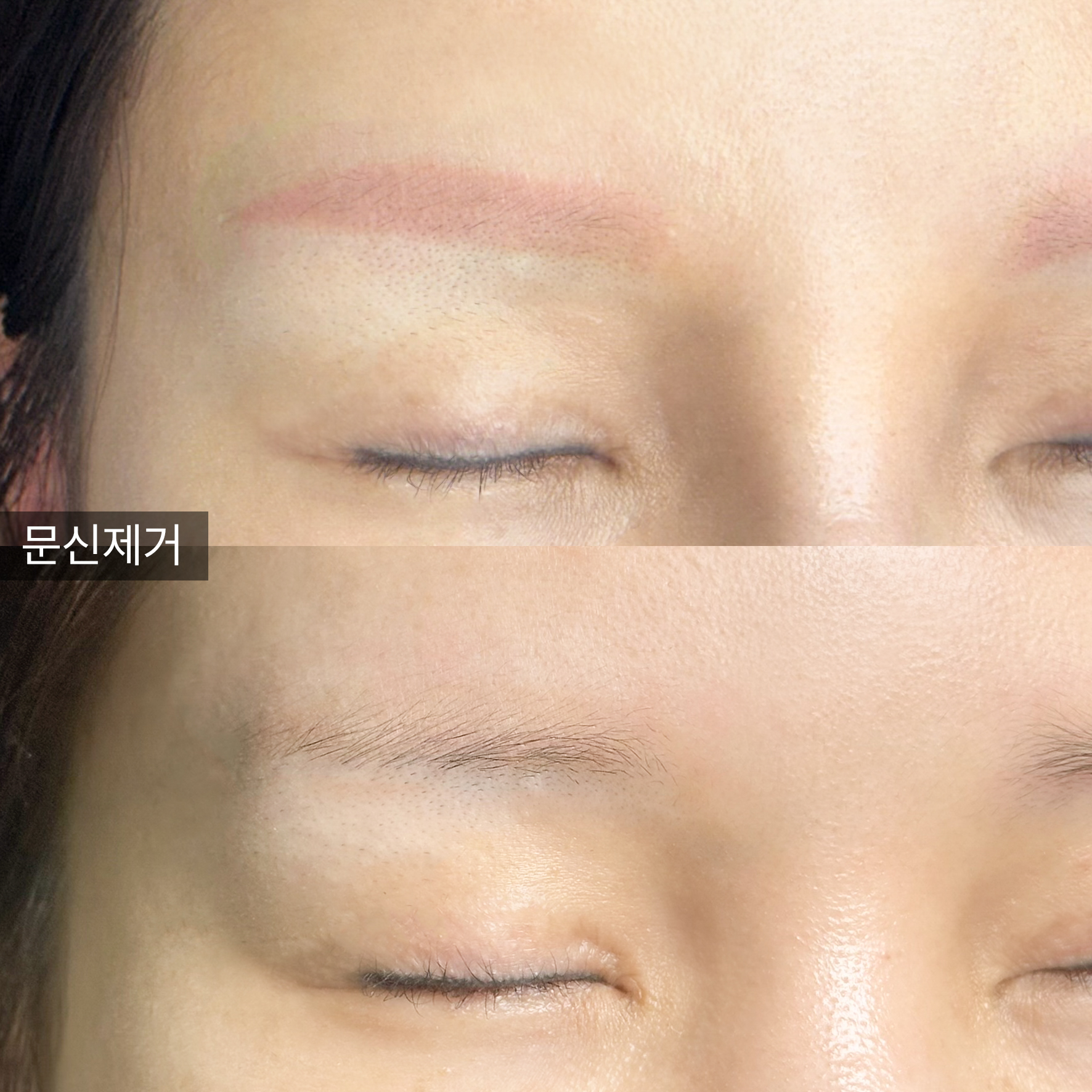 붉은잔흔 예시